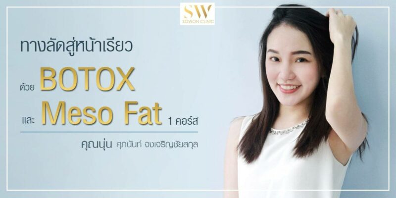 ทางลัดหน้าเรียว Botox