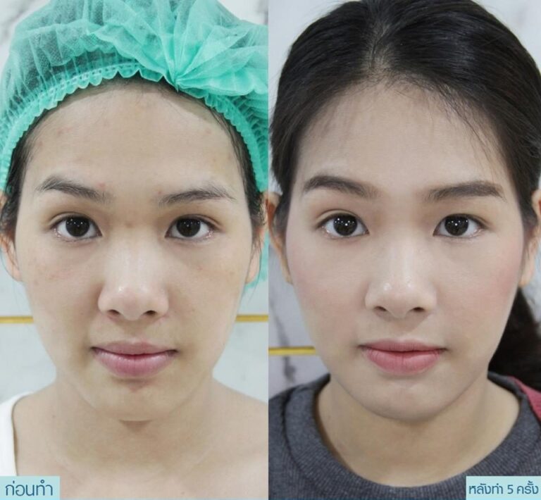 รีวิว MADE โซวอน