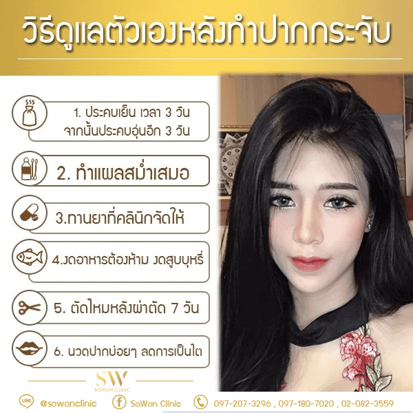 ดูแล-ทำปากกระจับ