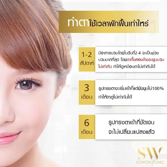 ทำตาพักฟื้น เท่าไหร่