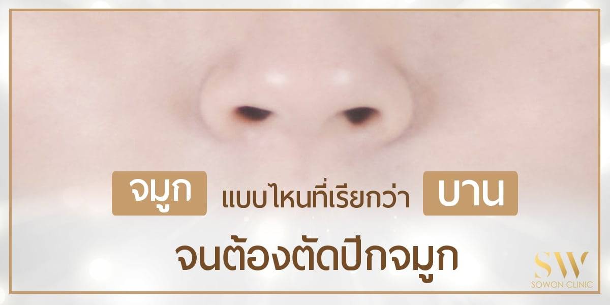 จมูกบาน แก้ได้