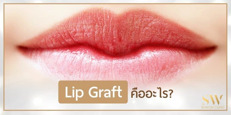 lip graft ปากกระจับ