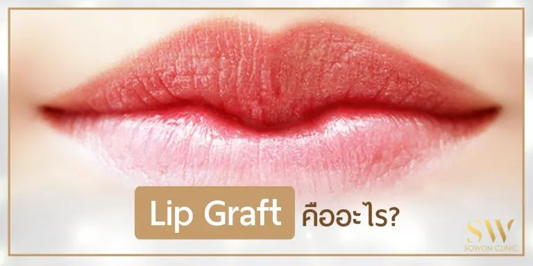 lip graft ปากกระจับ
