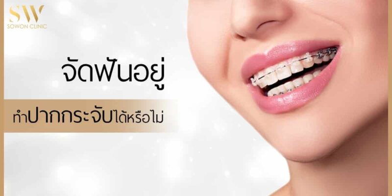 จัดฟัน ทำปากได้มั้ย