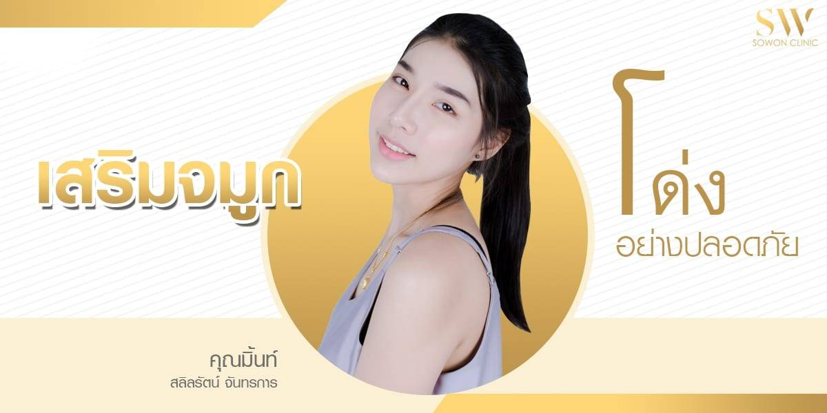 เสริมจมูก โซวอนรีวิว เสริมจมูก โซวอนรีวิว