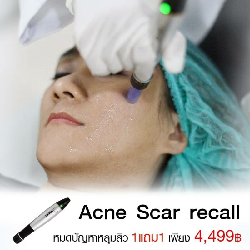 โปรโมชั่นรักษาสิว