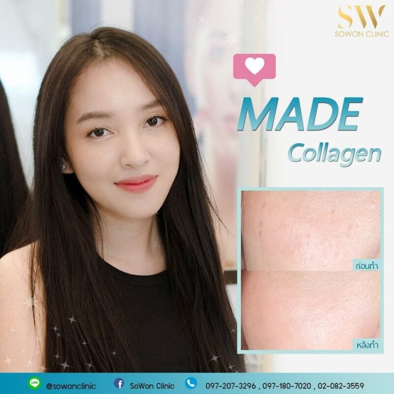 โปรโมชั่นหน้าใส