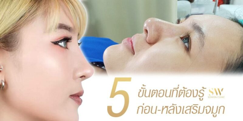 เสริมจมูก ต้องทำอย่างไร? 5 ขั้นตอนที่ต้องรู้ก่อนและหลังเสริมจมูก