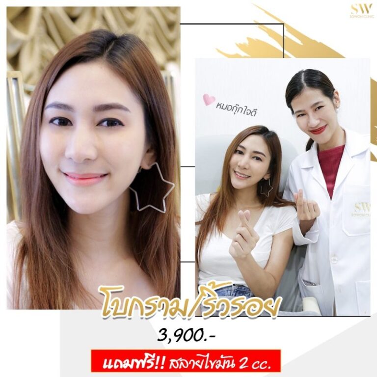 โปรโบลดกราม โปรโบริ้วรอย
