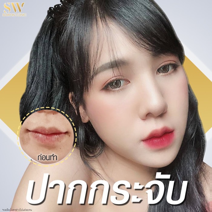 ปากกระจับ