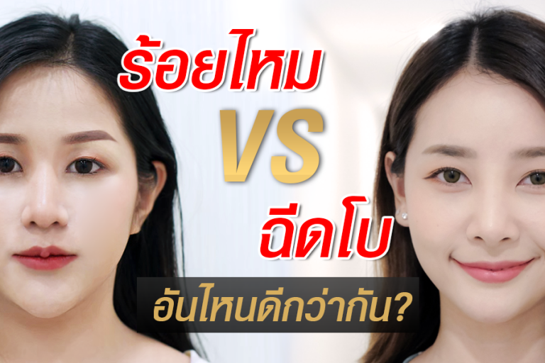 ร้อยไหมกับฉีดโบ