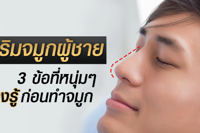 เสริมจมูกผู้ชาย 3 ข้อที่หนุ่มๆต้องรู้ก่อน