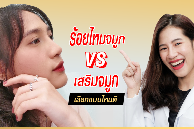 เสริมจมูกหรือร้อยไหมจมูก