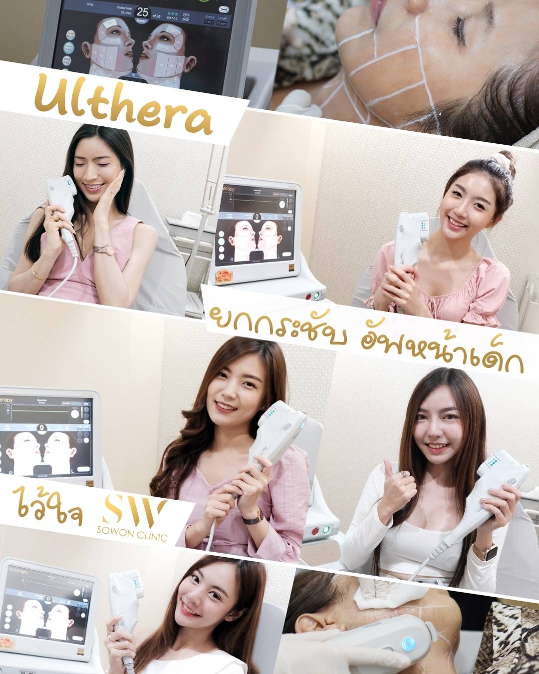 รีวิวUlthera อัลเทอร่า
