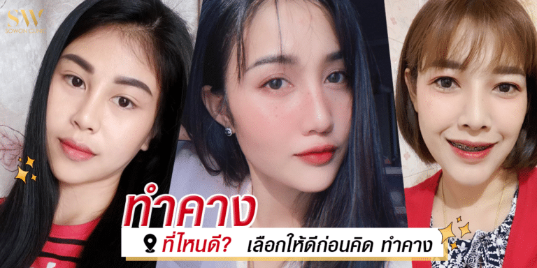 ทำคางที่ไหนดี เลือกให้ดีก่อนคิด ทำคาง