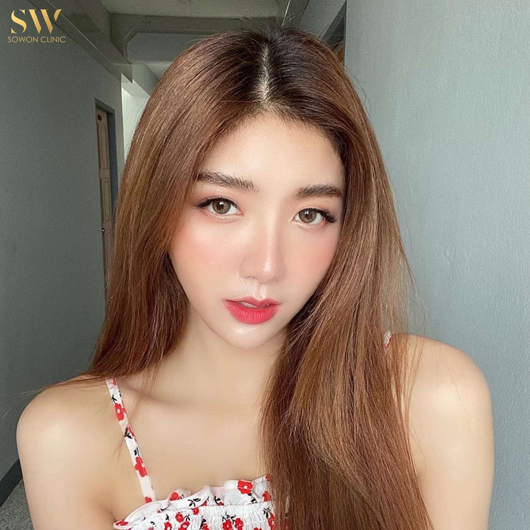 รีวิวฉีดโบท็อกซ์ลิฟท์กรอบหน้า ยกกระชับ