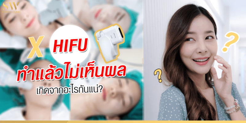 HIFU ทำแล้วไม่เห็นผล