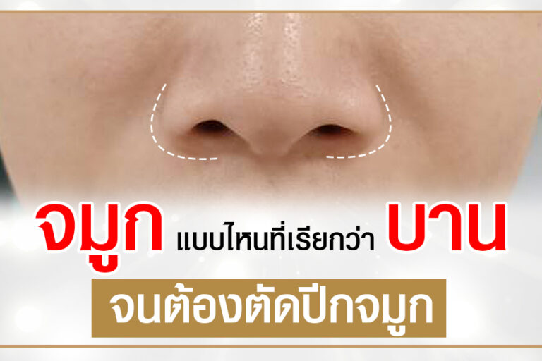 จมูกบาน