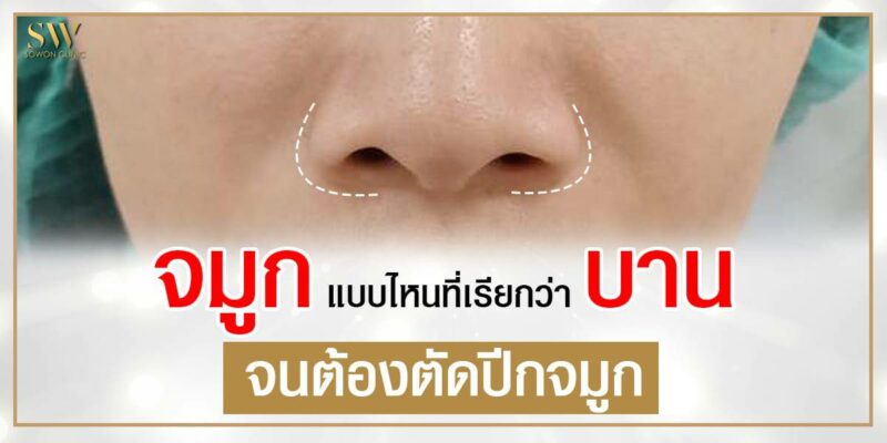 จมูกบาน