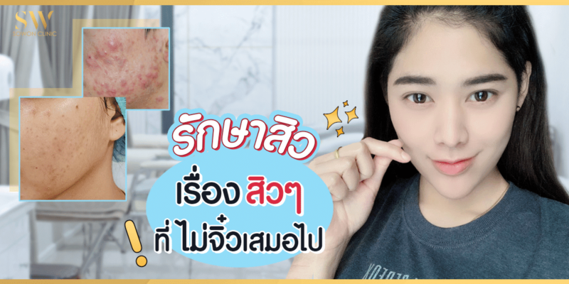 รักษาสิว เรื่องสิวๆ ที่ไม่จิ๋วเสมอไป