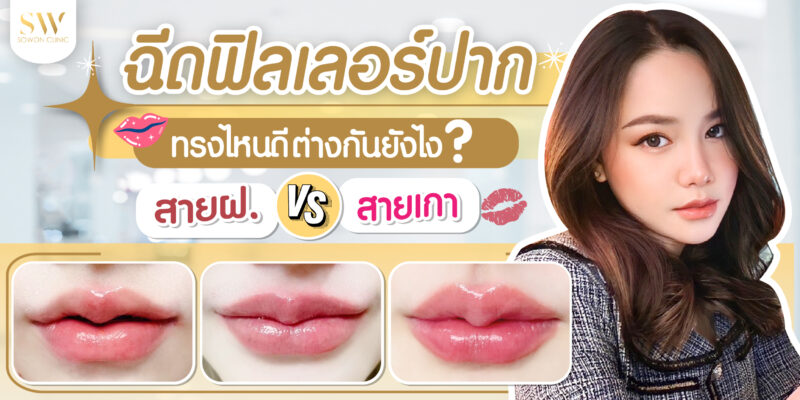 ฉีดฟิลเลอร์ปาก