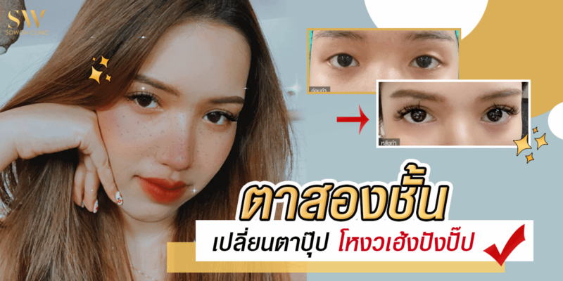 ตาสองชั้น เปลี่ยนตาปุ๊ป โหงวเฮ้งปังปั๊ป