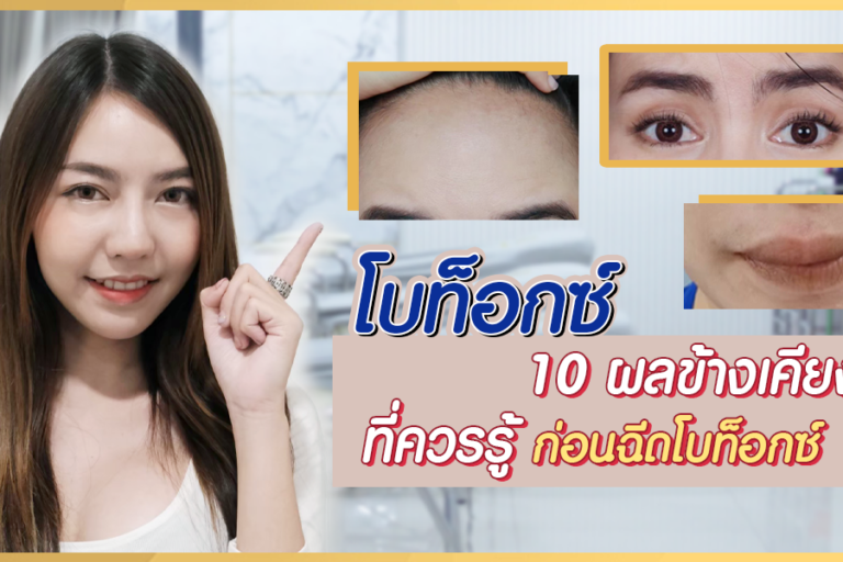 โบท็อกซ์ 10 ผลข้างเคียงที่ควรรู้ ก่อนฉีดโบท