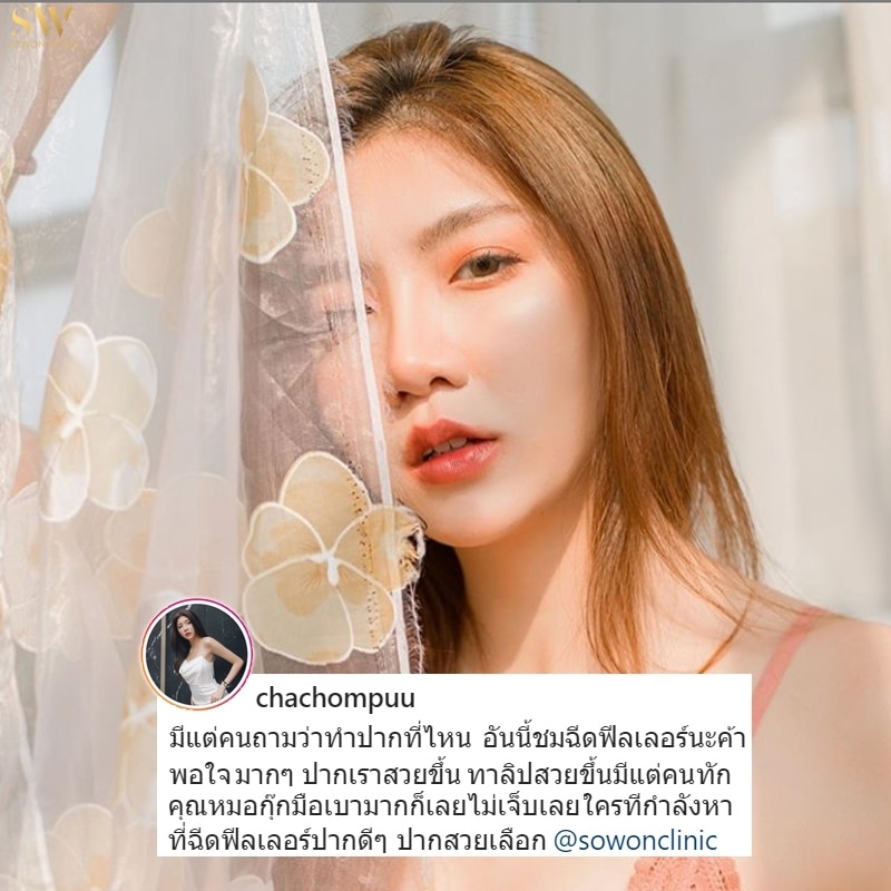 คำชมจากลูกค้า ฟิลเลอร์