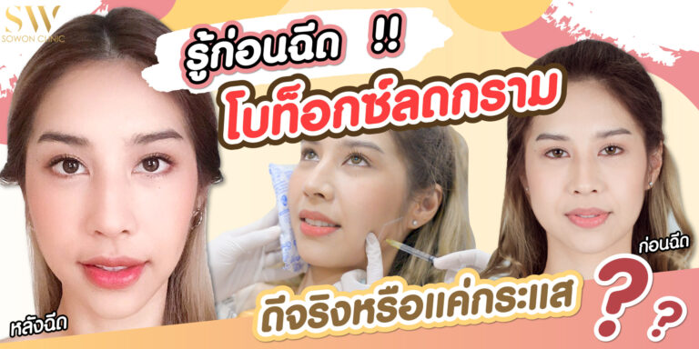 รู้ก่อนฉีด โบท็อกซ์ลดกราม ดีจริงหรือแค่กระแส