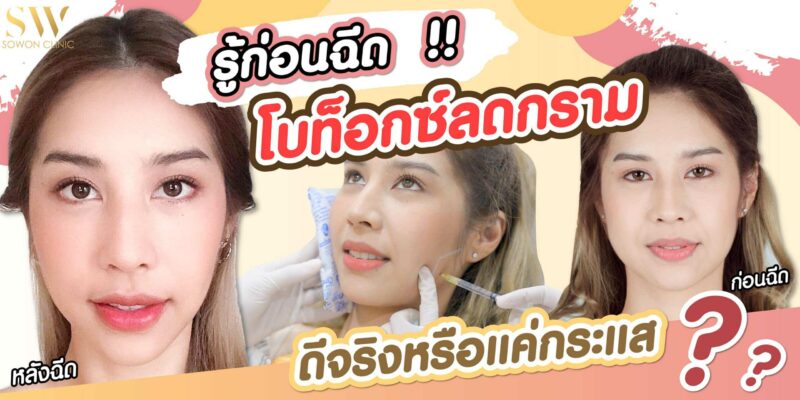 รู้ก่อนฉีด โบท็อกซ์ลดกราม ดีจริงหรือแค่กระแส