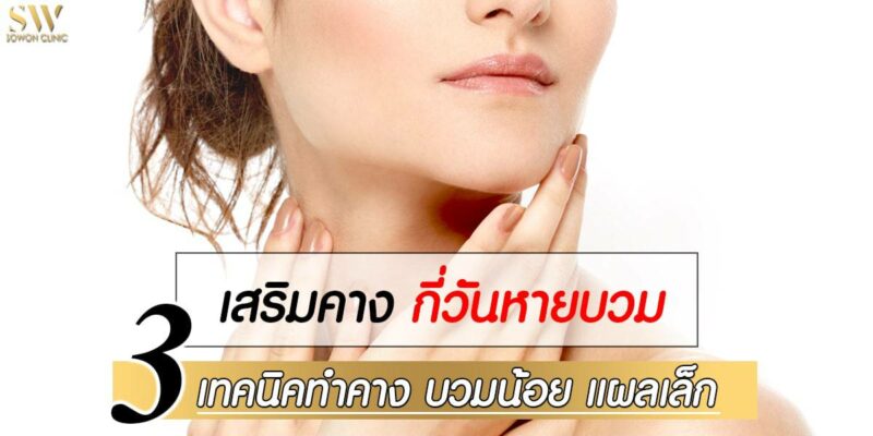 เสริมคาง กี่วันหายบวม