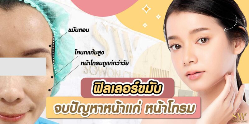 ปกฟิลเลอร์ขมับ-01