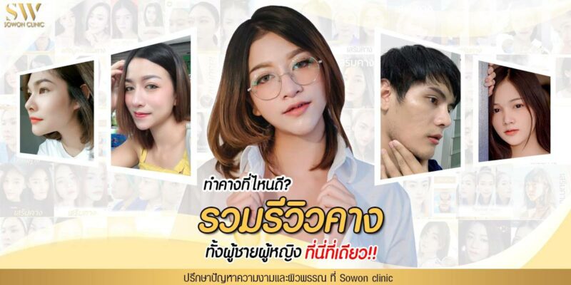 รีวิว เสริมคางชายหญิง