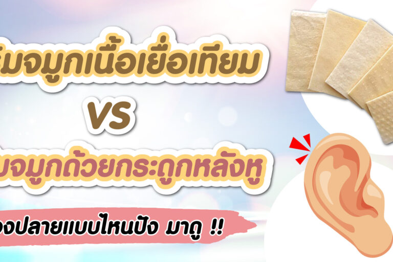 เสริมจมูกเนื้อเยื่อเทียม vs หลังหู-01