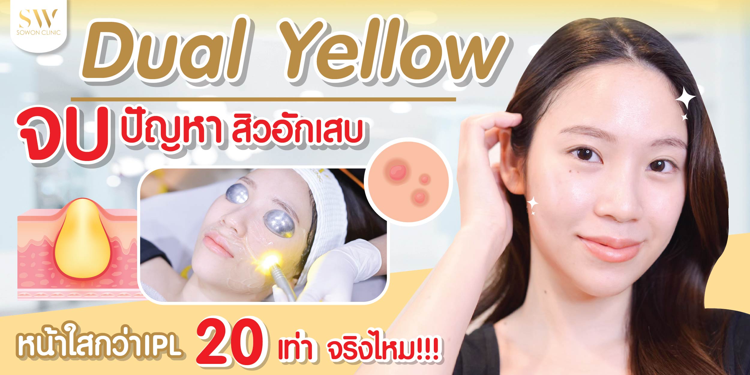 Dual yellow
