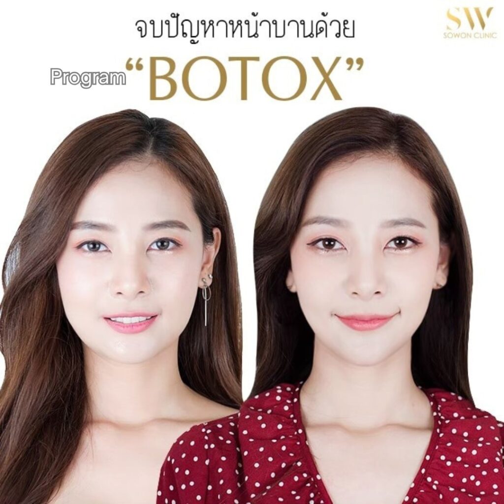 โปรแกรมโบท็อก