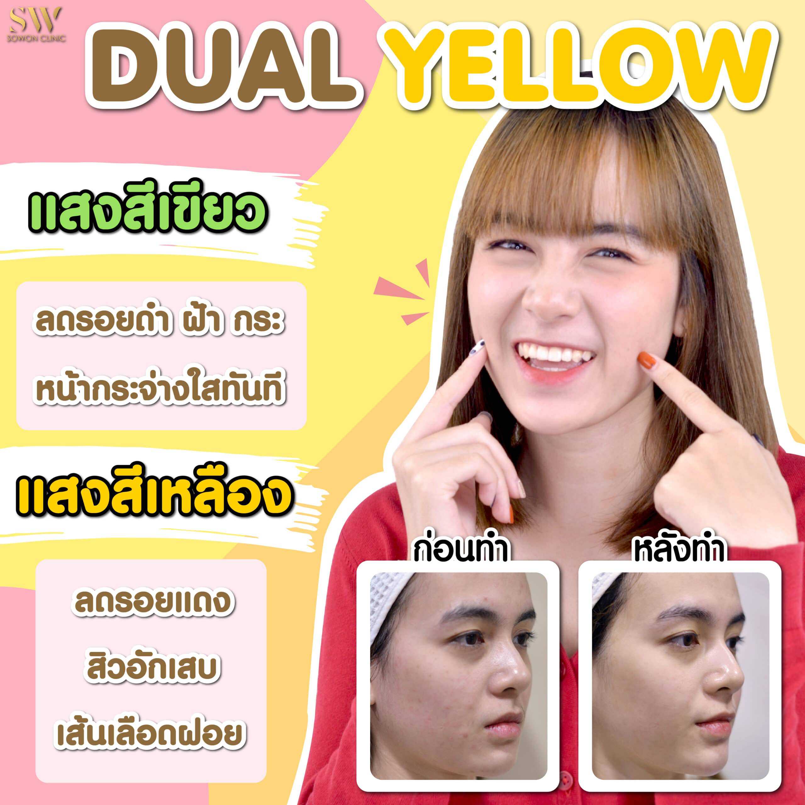 dual yellow