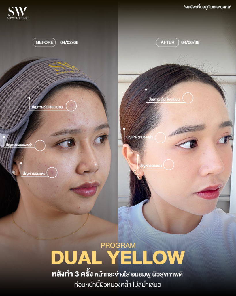 dualyellow