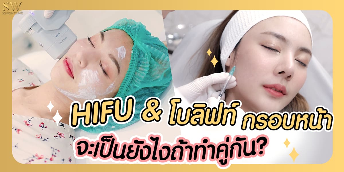 hifu+Botox hifu+Botox