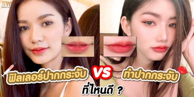 ฟิลเลอร์ ทำปาก