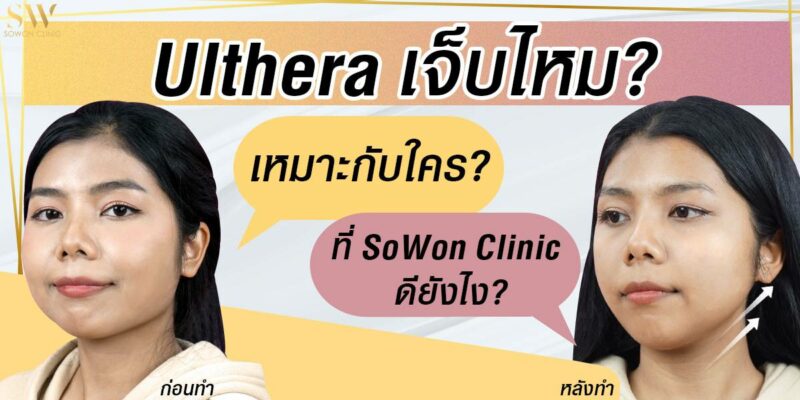 อัลเทอร่า