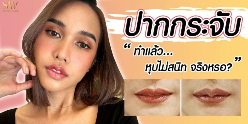 ปากกระจับ หุบไม่สนิท ปากกระจับ หุบไม่สนิท