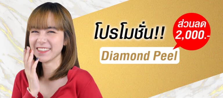 diamond peel เรื่องผลัดเซลล์ผิว