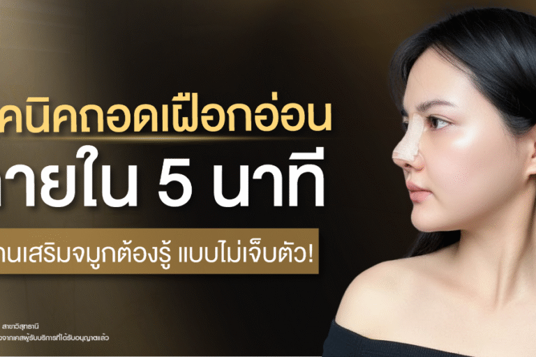 เสริมจมูก เฝือกอ่อน