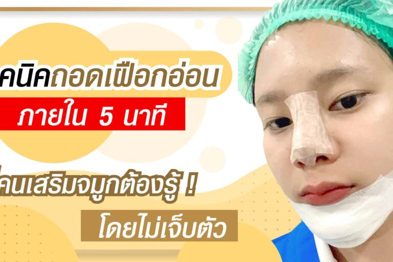 เสริมจมูก เฝือกอ่อน