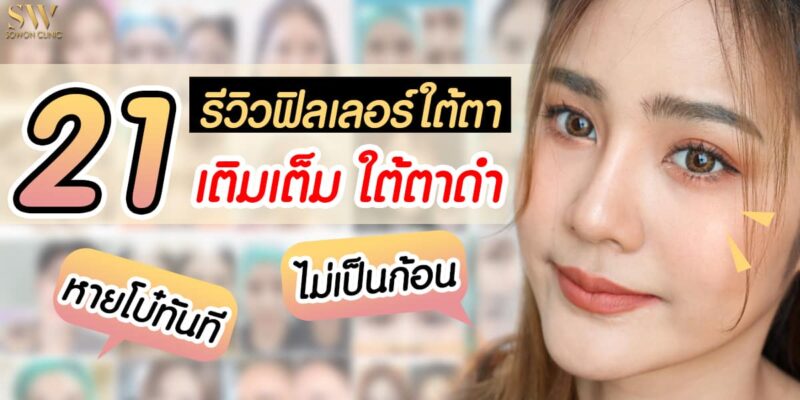 รวมรีวิวฟิลเลอร์ใต้ตา รวมรีวิวฟิลเลอร์ใต้ตา