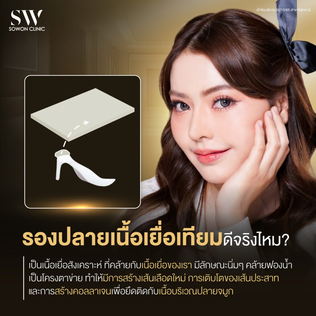 เสริมจมูกต้องรู้04