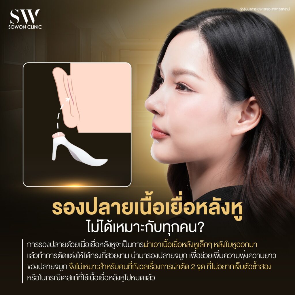 เสริมจมูกต้องรู้05