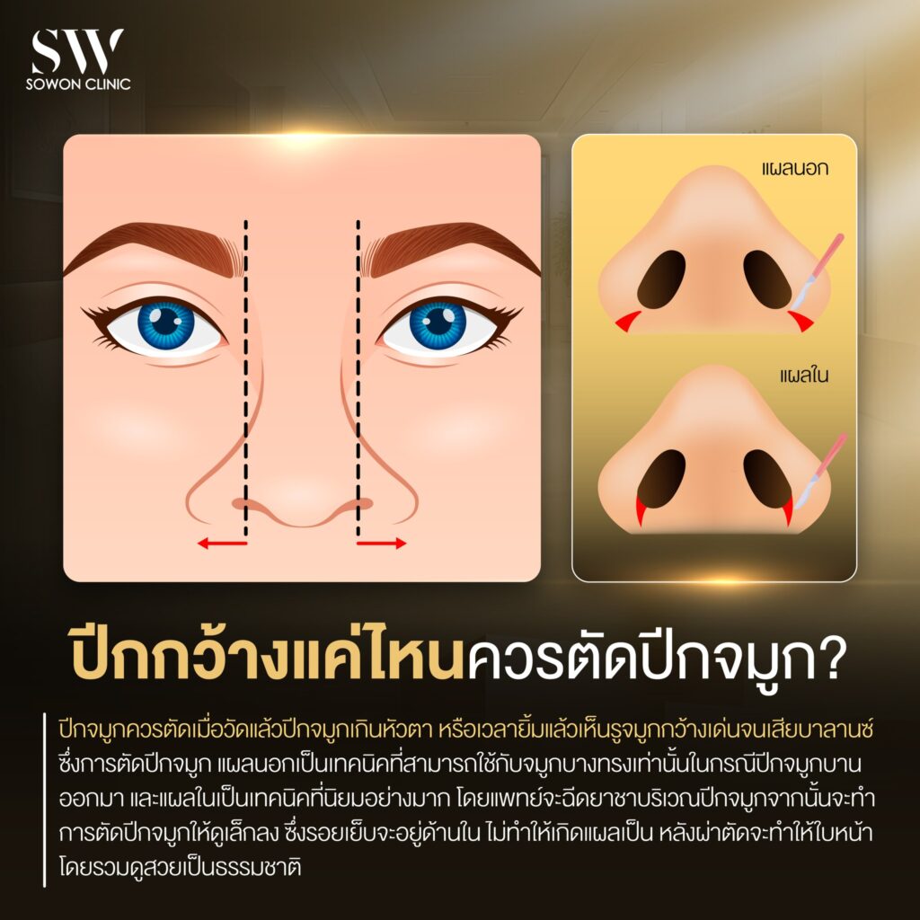เสริมจมูกต้องรู้06