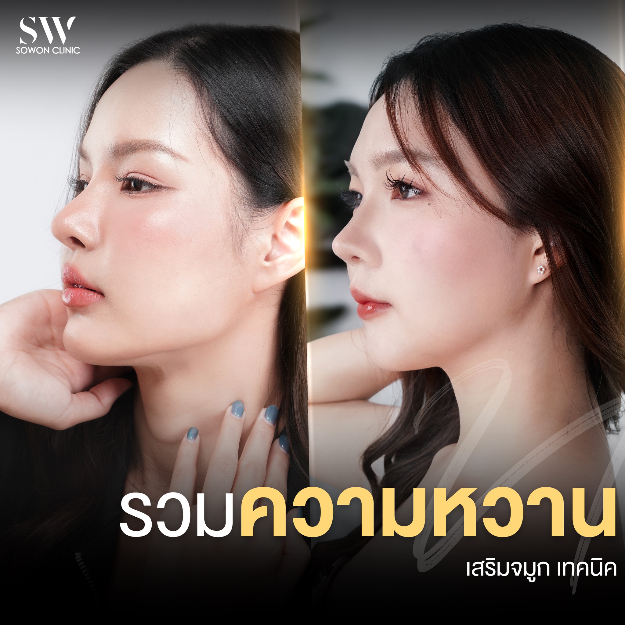 เสริมจมูกรีวิว 01